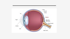 Prezentācija 'Makulas deģenerācija', 3.