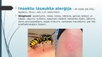 Prezentācija 'Alerģijas, to veidi, profilaktisko pasākumu kopums', 6.