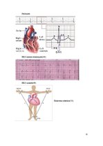 Referāts 'Elektrokardiogrammas interpretācija', 15.