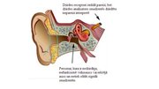 Prezentācija 'Dzirdes traucējumi skolas vecuma bērniem', 17.