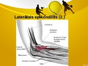 Referāts 'Laterālais epikondilīts jeb tenisista elkonis', 31.