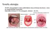 Prezentācija 'Tonsilīts', 2.