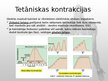 Prezentācija 'Muskuļu fizioloģija', 30.