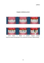 Diplomdarbs 'Periodonta slimības un to profilakses pasākumi', 46.