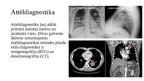 Prezentācija 'Plauša vēža jaunākas diagnostikas un ārstēšanas metodes', 4.