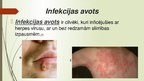 Prezentācija 'Herpes vīruss', 3.