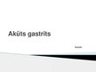 Prezentācija 'Akūts gastrīts', 1.