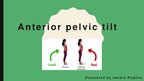 Prezentācija 'Anterior Pelvic Tilt', 1.