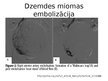 Prezentācija 'Invazīvās radioloģijas ārstēšanas metodes mūsdienu dzemdniecībā un ginekoloģijā', 7.