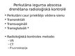 Prezentācija 'Invazīvās radioloģijas ārstēšanas metodes mūsdienu dzemdniecībā un ginekoloģijā', 17.