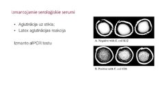 Prezentācija 'Escherichia coli mikrobioloģiskās diagnostikas principi', 14.