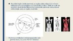 Prezentācija 'Fizikas loma slimību diagnostikā un terapijā', 10.