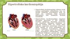 Prezentācija 'Kardiomiopātija Bērniem', 5.