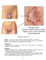 Konspekts 'Ginekoloģiskās infekcijas saslimšanas', 11.