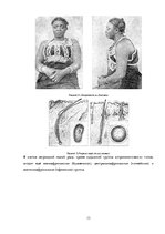 Referāts 'Происхождение человеческих рас и их распространение', 13.