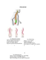 Referāts 'Mugurkaula deformāciju izraisošie faktori', 22.