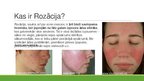 Prezentācija 'Zīmola "Rosacea Care" ieviešana Latvijas tirgū', 3.