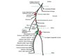 Prezentācija 'N.Radialis bojājums elkoņa rajonā', 2.