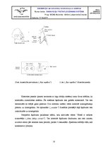 Referāts 'Gaisa kuģu pretapledošanas sistēma', 16.
