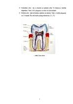 Referāts 'Mutes dobuma higiēna, izplatītākās zobu slimības un to cēloņi', 5.