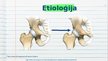 Prezentācija 'Stāvoklis pēc gūžas locītavas endoprotezēšanas', 3.