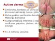 Prezentācija 'Lokālas infekcijas neonatālā periodā', 2.